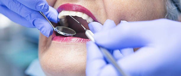 Best Cracked Tooth Emergency Dentist  in Russell, GA