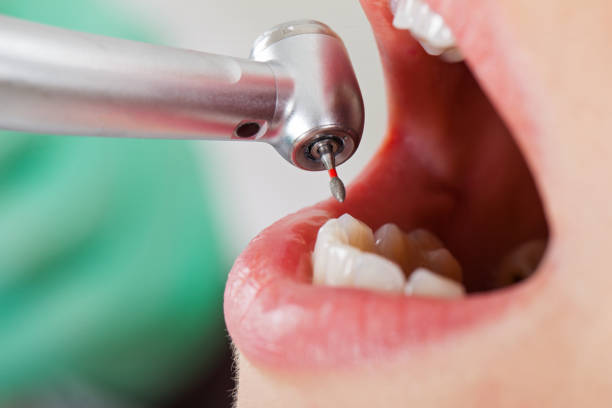 Best Emergency Dentist for Kids  in Russell, GA